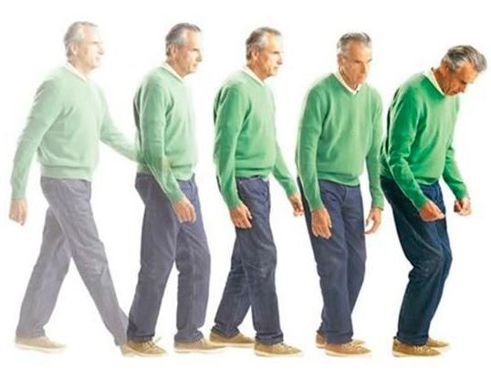 trastornos-movimiento